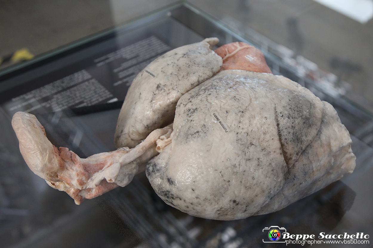 VBS_2659 - Polmoni di un non fumatore - Mostra Body Worlds.jpg